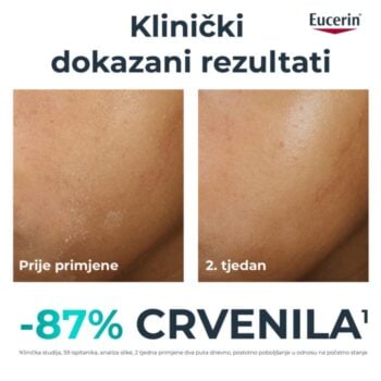Eucerin DermoPure Clinical dopunska umirujuća krema 40ml