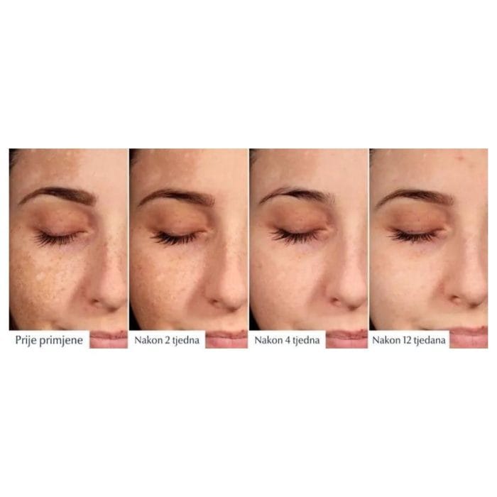 Eucerin Anti-Pigment dvofazni serum za smanjenje hiperpigmentacije