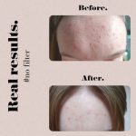 Juvy Skin OVERACHIEVER eksfolijacijski jastučići sa dodatkom peptida
