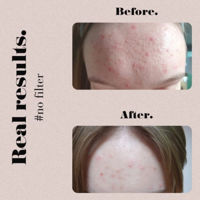 Juvy Skin OVERACHIEVER eksfolijacijski jastučići sa dodatkom peptida