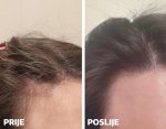 Yasenka Skinage HAIR Strong 60 kapsula