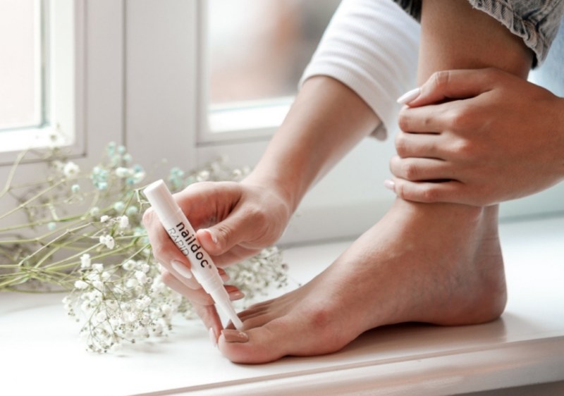 NailDoc – učinkovito rješenje protiv gljivica na noktima